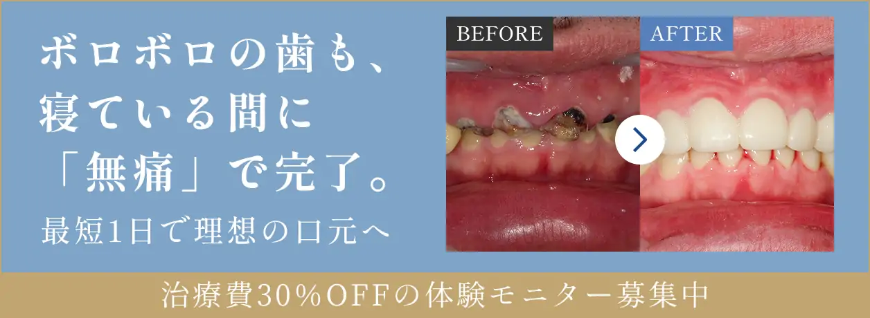 ボロボロの歯も寝ている間に無痛で完了 治療費30%OFFの体験モニター募集中